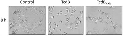 Quantitative Phosphoproteome Analysis of Clostridioides difficile Toxin B Treated Human Epithelial Cells